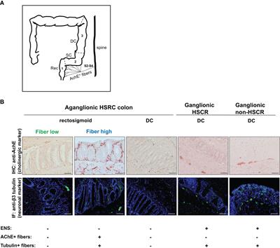 Cholinergic Signaling Attenuates Pro-Inflammatory Interleukin-8 Response in Colonic Epithelial Cells